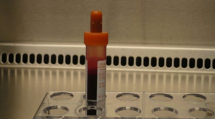 Napi ötven adag vért vesznek le Felsőgödön