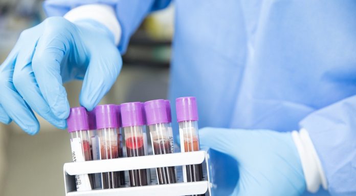 Megnövekedhet a várakozás vérvételre Alsó- és Felsőgödön is