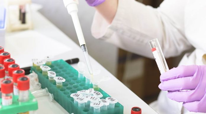 Ne a hét közepére időzítse a labort Alsógödön!