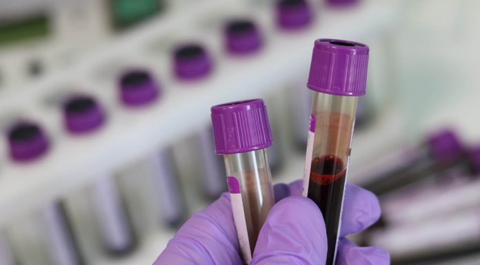 Így működnek a gödi laborok az ünnepek tájékán