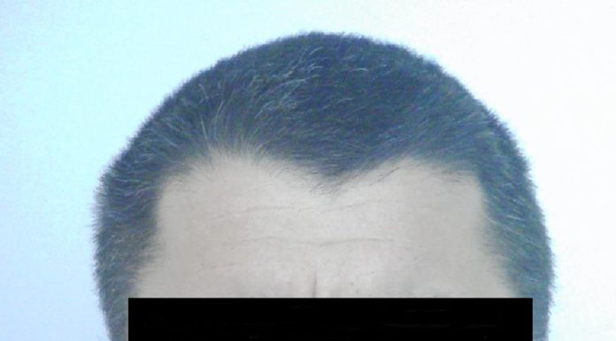 Halálos baleset miatt körözik